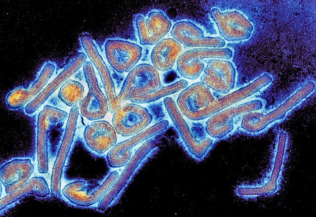 Uitbraak van Marburgvirus in Afrika: komt een nieuwe pandemie dichterbij?